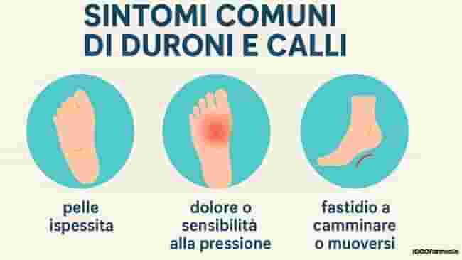 Calli e duroni a piedi e mani: cause, sintomi, rimedi e cure efficaci 