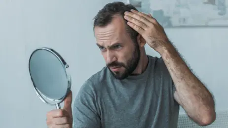 Minoxidil: benefici, effetti collaterali e utilizzo