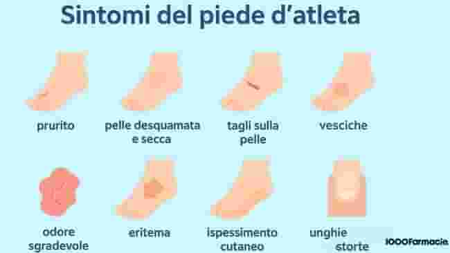 Piede d’atleta: cos’è, sintomi, cause e rimedi alla micosi 