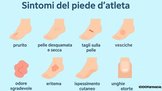 Piede d’atleta: cos’è, sintomi, cause e rimedi alla micosi 