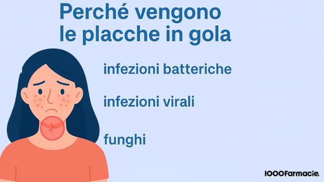 Placche in gola: cause, sintomi, farmaci e rimedi naturali per curarle