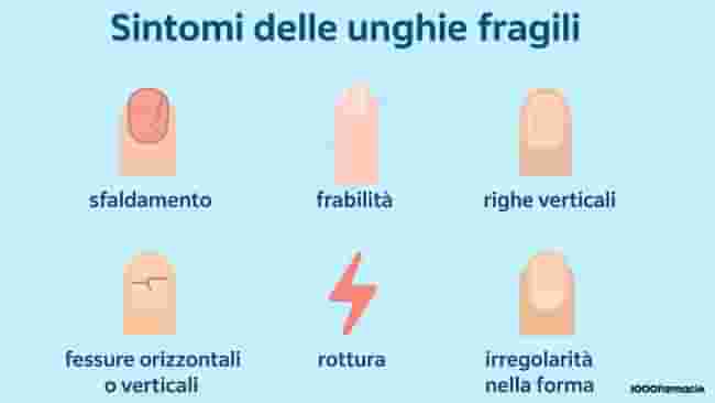 Unghie fragili, deboli, che si spezzano: cause e rimedi per rinforzarle