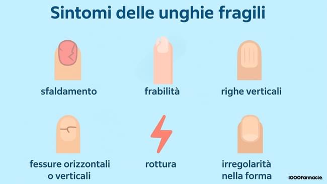 Unghie fragili, deboli, che si spezzano: cause e rimedi per rinforzarle