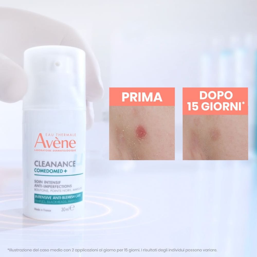Gel Detergente e trattamento anti imperfezioni Avène