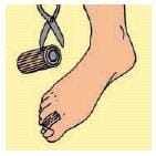 TUBOLARE CON GEL SU UN LATO 10CM DIGI-STRIP M