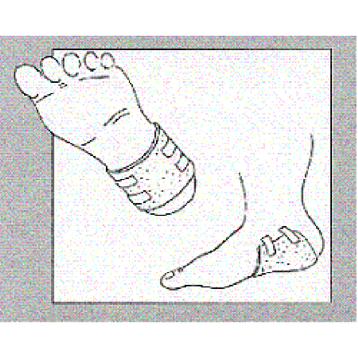 MEDICAZIONE ASSORBENTE IN POLIURETANO ESPANSO LIGASANO STRUTTURA A NIDO D'APE NON STERILE 15X15CM ALTEZZA 1CM 10 PEZZI