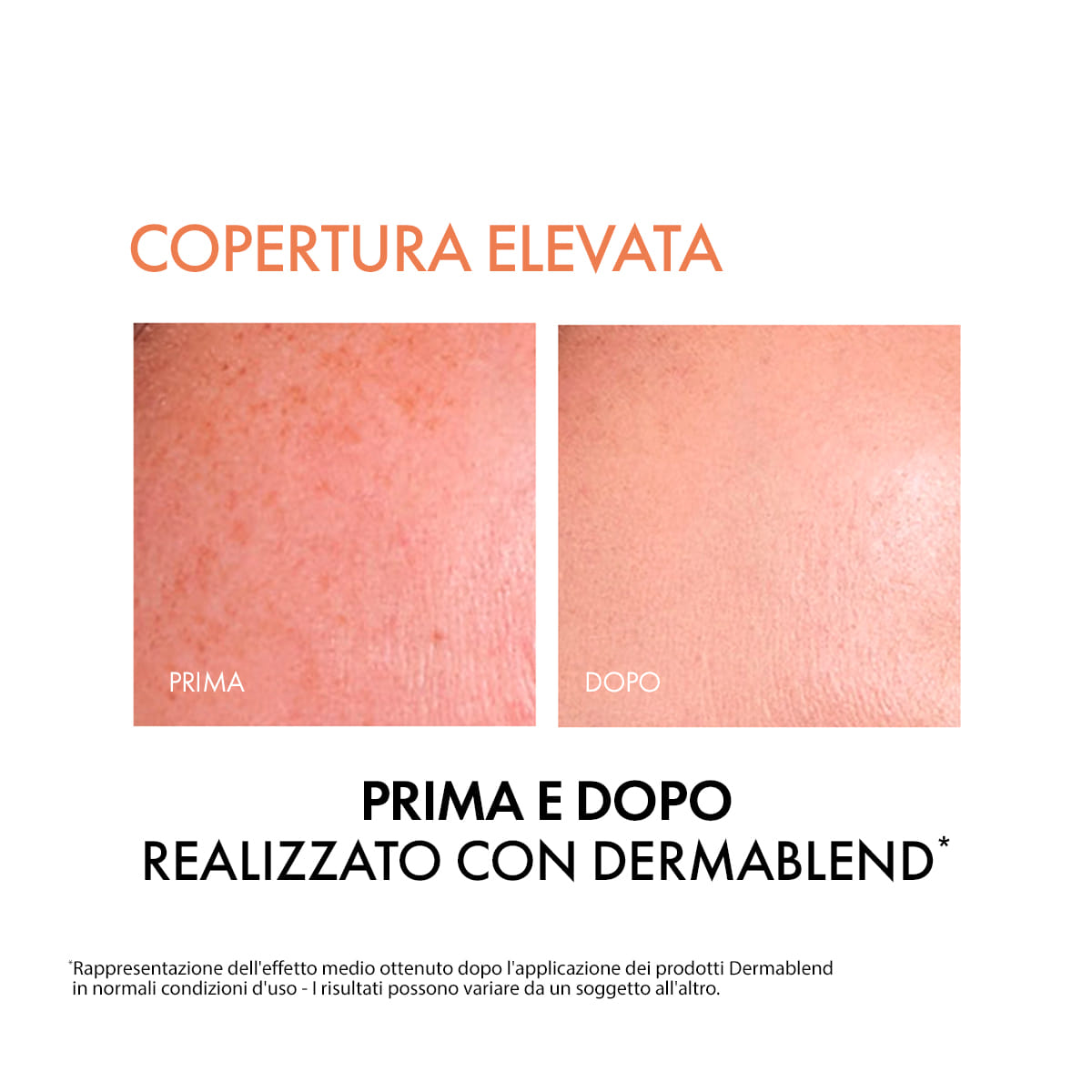 DERMABLEND FLUIDO 45 30 ML