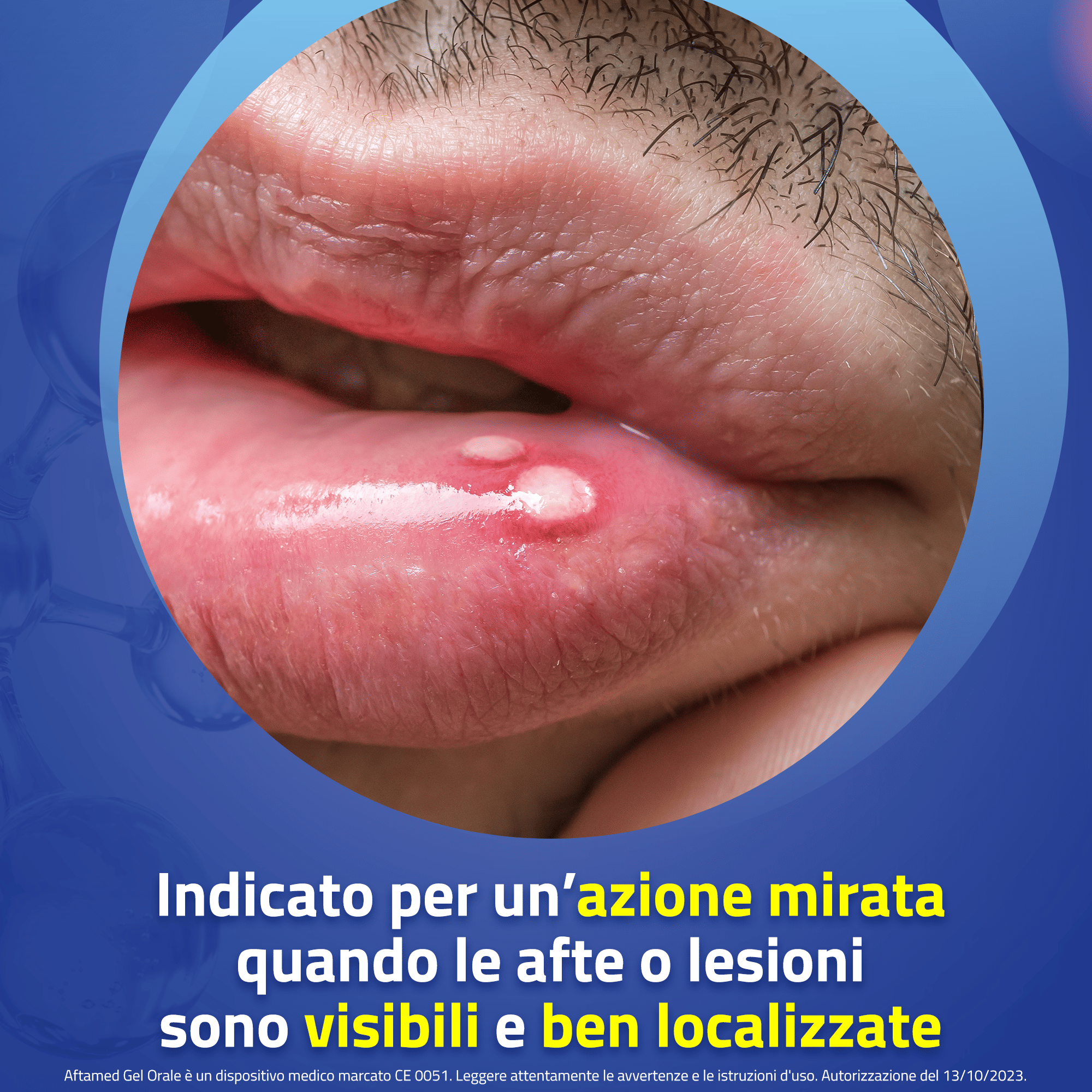 GEL AFTAMED ACIDO IALURONICO TUBO 15 ML