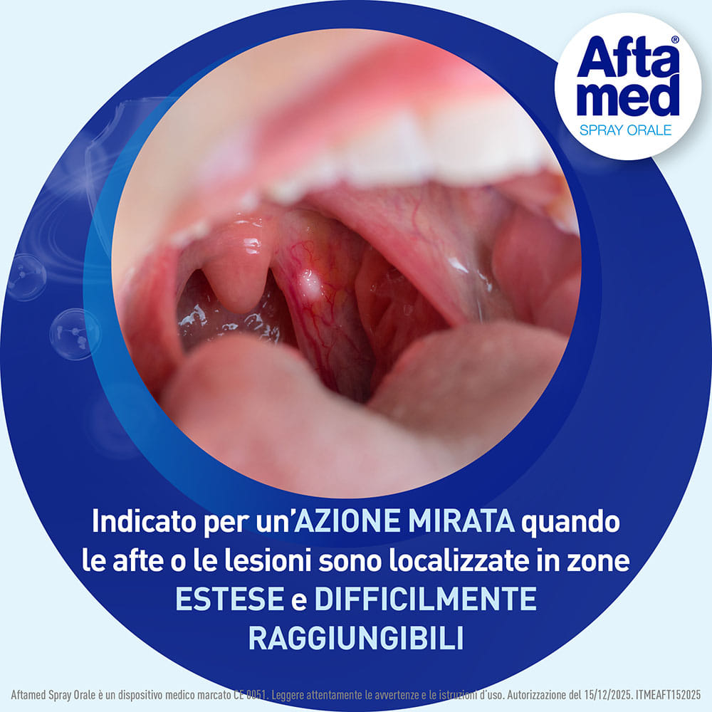 AFTAMED SPRAY FLACONE 20 ML