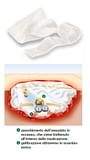 MEDICAZIONE STERILE IN ALGINATO DI CALCIO COMPRESSA SUPRASORB A ALTAMENTE ASSORBENTE 10X10 CM 10 PEZZI