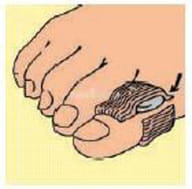 CUSCINETTO DIGITALE PER PIEDE DIGITAL S/M