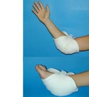 GOMITIERA/TALLONIERA IN VELLO SINTETICO PER LA PREVENZIONE DELLE PIAGHE DA DECUBITO A LIVELLO DEI GOMITI E/O DEI TALLONI NEI PAZIENTI LUNGODEGENTI. SISTEMA DI FISSAGGIO A VELCRO