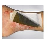MEDICAZIONE IN TESSUTO NON TESSUTO AL CARBONE ATTIVO E ARGENTO TAMPONE 10X10CM 10 PEZZI