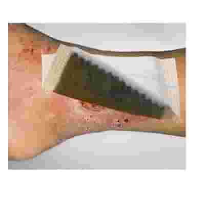 MEDICAZIONE IN TESSUTO NON TESSUTO AL CARBONE ATTIVO E ARGENTO TAMPONE 10X10CM 10 PEZZI
