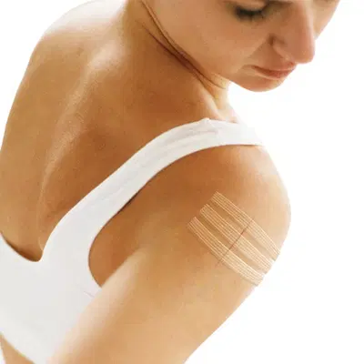 CEROTTO PER SUTURA NEXCARE STERISTRIP 6X75 MM + 3X75 MM CEROTTO PER SUTURA NEXCARE STERISTRIP 6X75 MM + 3X75 MM