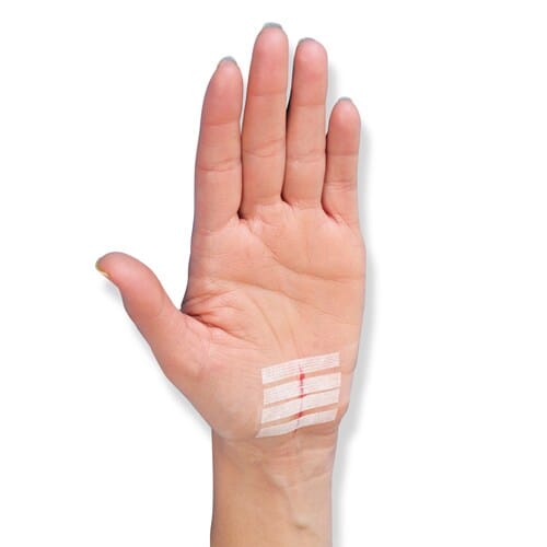 Cerotto sutura Nexcare Steri-Strip 6x75mm e 3x75mm