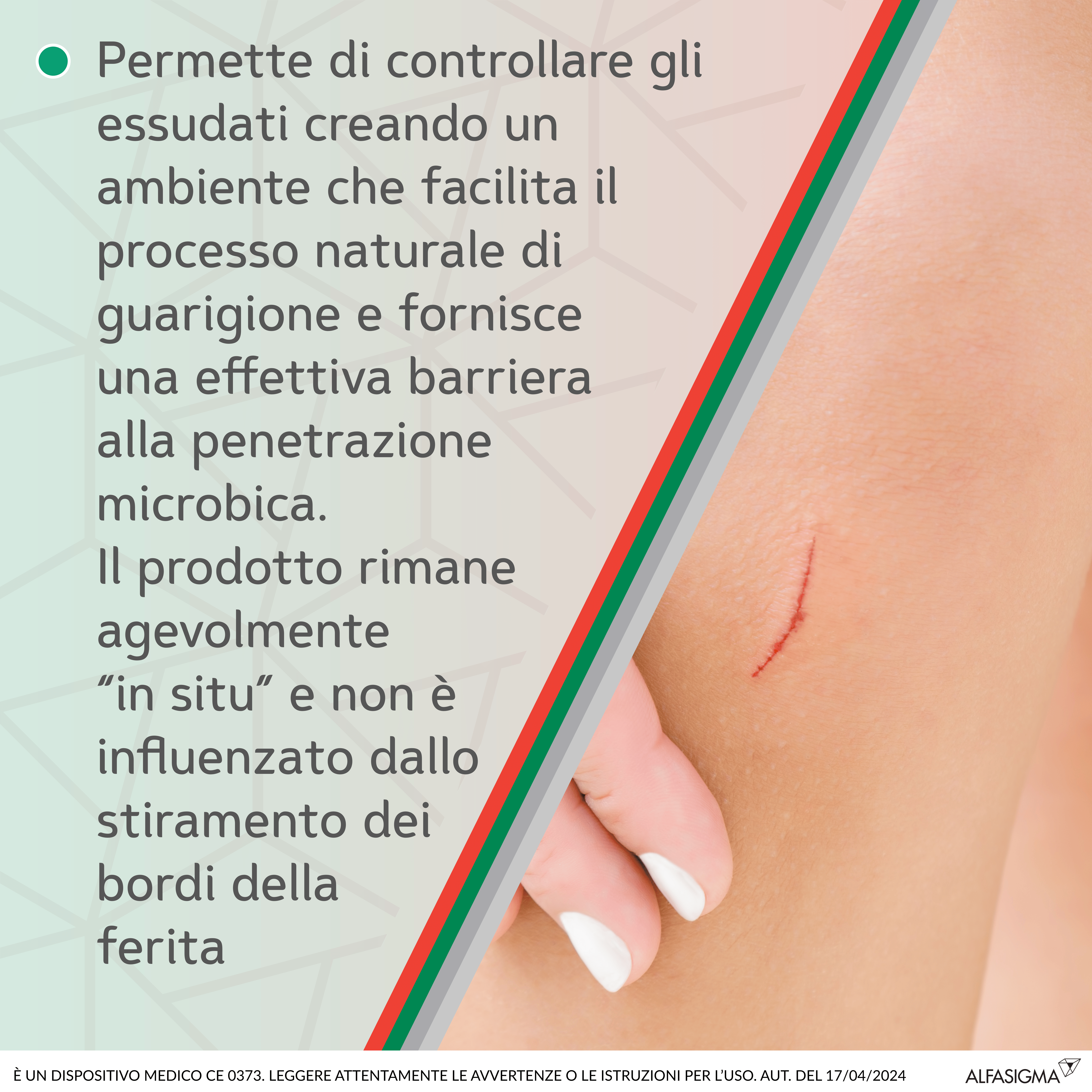 MEDICAZIONE IN POLVERE SPRAY CON CAOLINO E ARGENTO SULFADIAZINA 1% SOFARGEN SPRAY 10 G BOMBOLETTA PRESSURIZZATA 125 ML