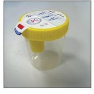 KIT CONTENITORE URINA SECUR BOX TAPPO GIALLO A VITE CON PUNTO DI PRELIEVO 120 ML 1 PEZZO