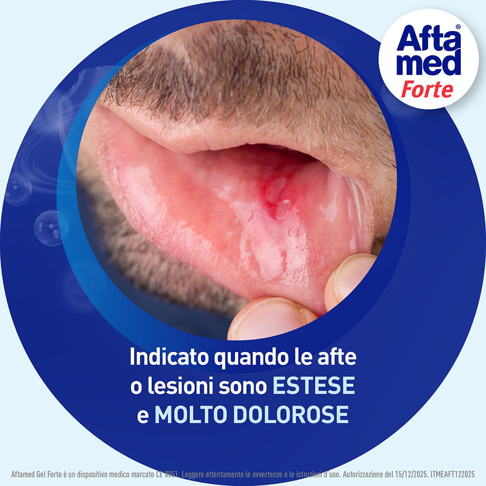 AFTAMED GEL FORTE SCUDO 8 ML