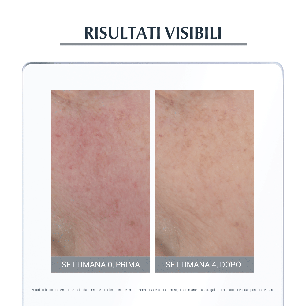 EUCERIN ANTIROSE GIORNO TRATTAMENTO NEUTRALIZZANTE SPF25 50 ML