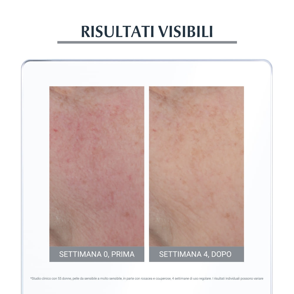 EUCERIN ANTIROSE TRATTAMENTO LENITIVO NOTTE  50ML