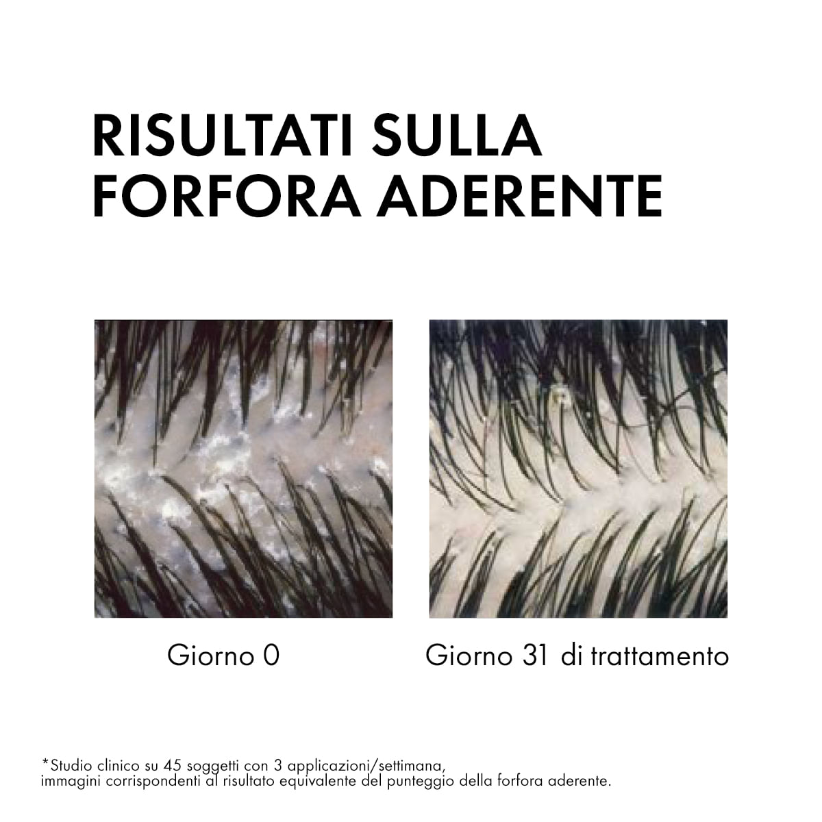 DERCOS SHAMPO ANTIFORFORA GRASSI 200 ML