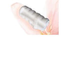 TAMPONE VAGINALE PER L'INCONTINENZA FEMMINILE CONTAM MED LARGE 33X61 MM 5 PEZZI