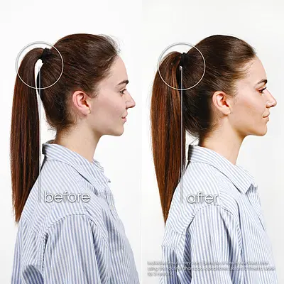 KLORANE TRATTAMENTO FORTIFICANTE INTENSO CHININA 100 ML KLORANE TRATTAMENTO FORTIFICANTE INTENSO CHININA 100 ML