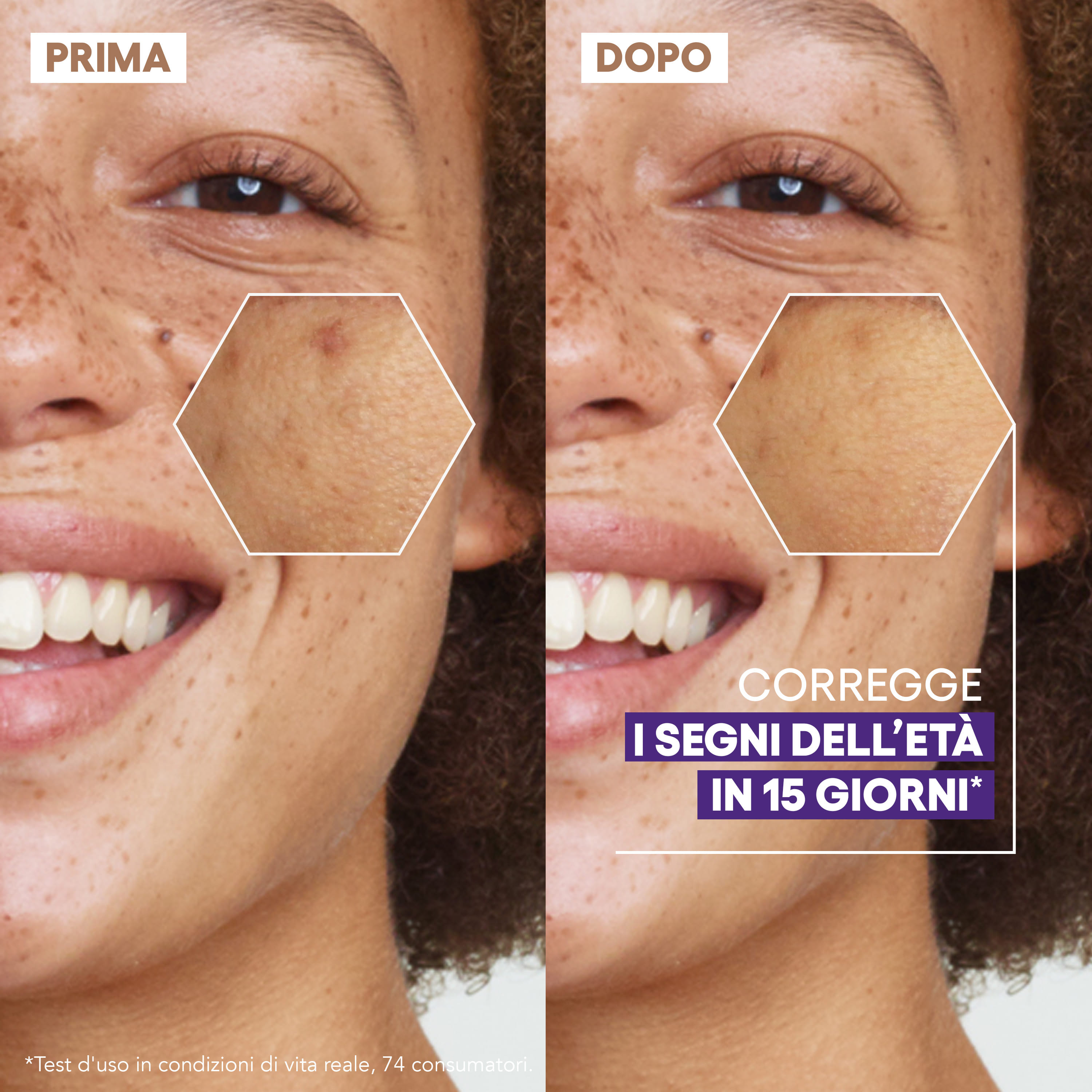 EPITHELIALE ULTRA REPAIR Siero ristrutturante luminosità