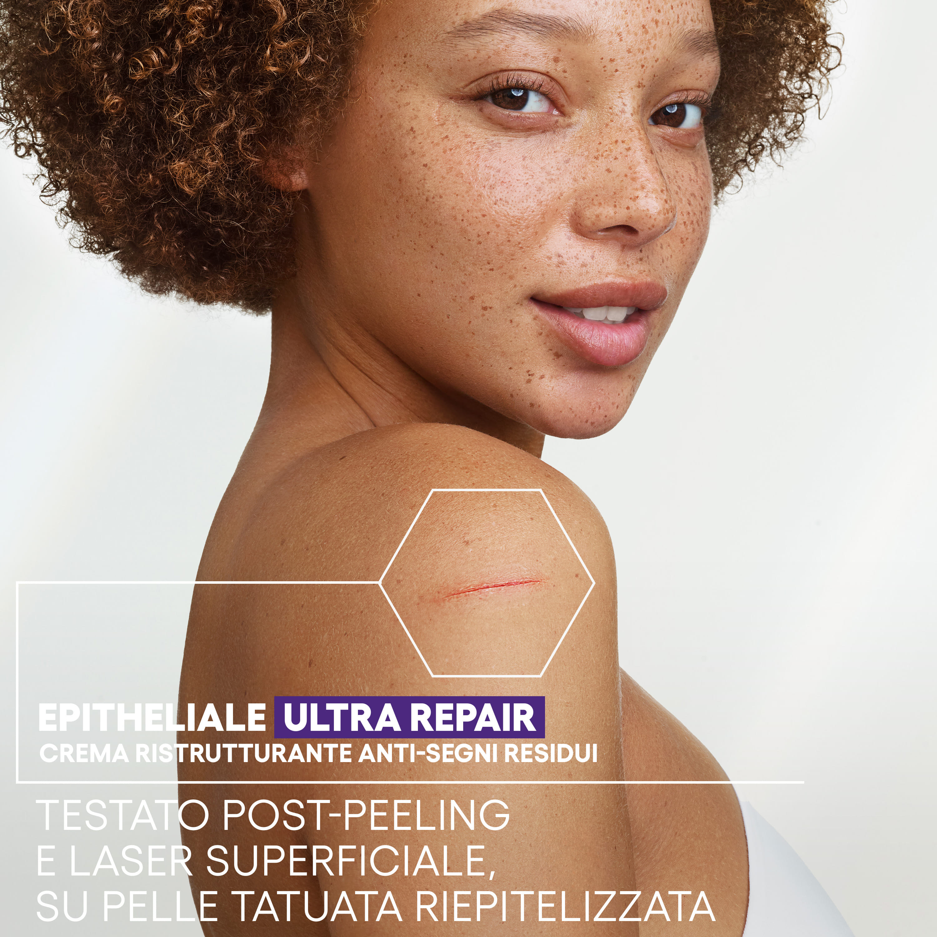 EPITHELIALE ULTRA REPAIR CREMA RISTRUTTURANTE ANTI SEGNI RESIDUI 100 ML