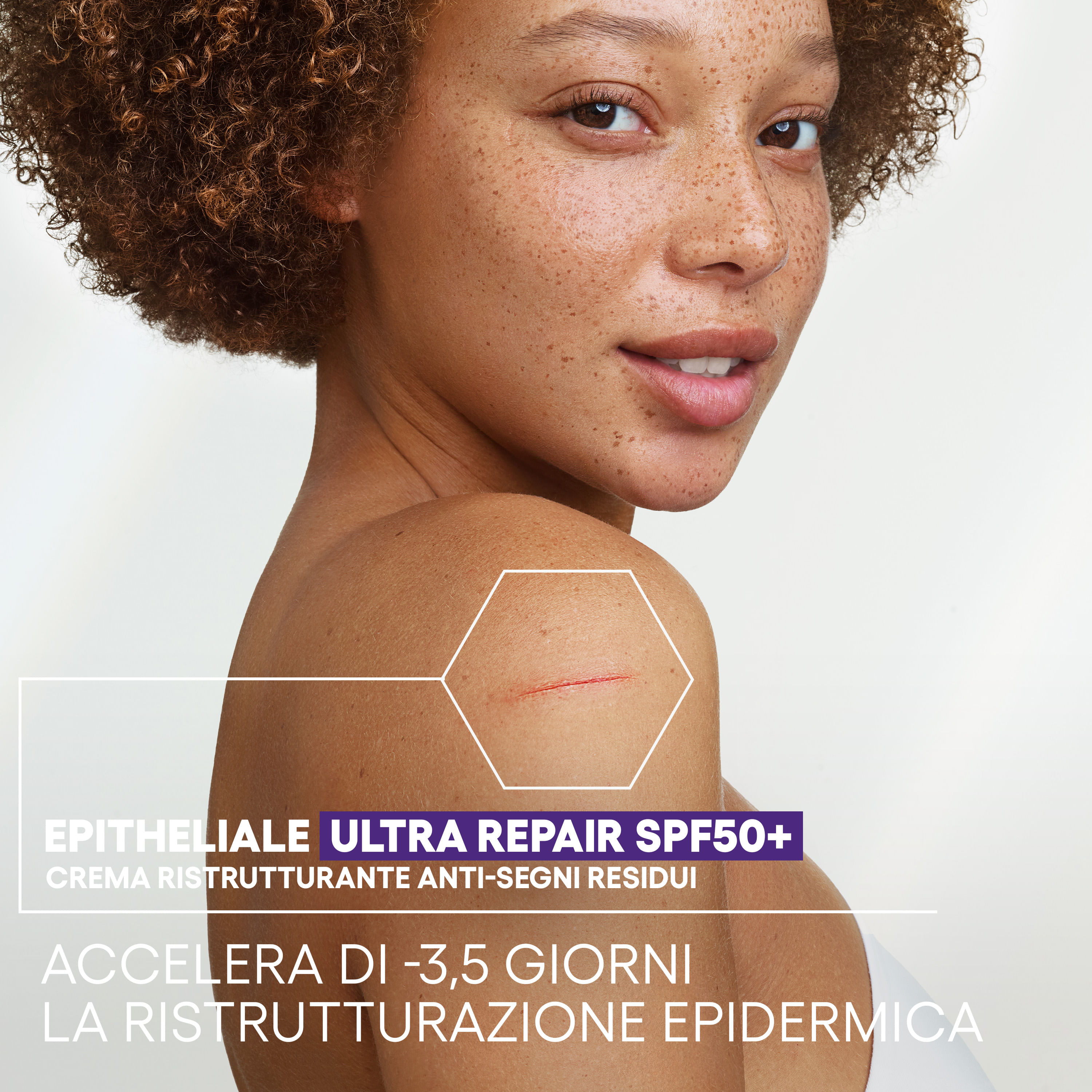 EPITHELIALE ULTRA REPAIR SPF50+ CREMA RISTRUTTURANTE ANTI SEGNI RESIDUI 40 ML