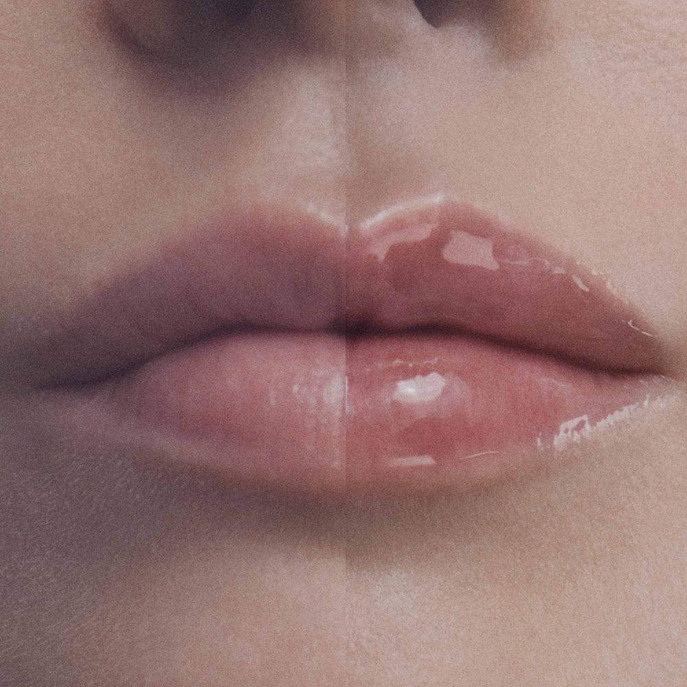 FILORGA HYALU-FILLER LIPS FLACONE PEN 4 G