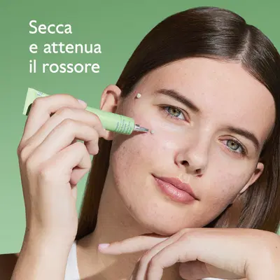 VINOPURE SOLUZIONE SALICILICA STOP BRUFOLI 15 ML VINOPURE SOLUZIONE SALICILICA STOP BRUFOLI 15 ML