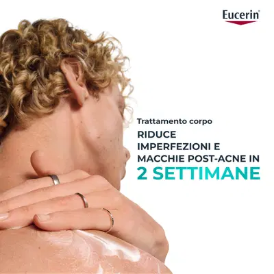 EUCERIN DERMOPURE CLINICAL CREMA CORPO TRIPLA AZIONE 200 ML EUCERIN DERMOPURE CLINICAL CREMA CORPO TRIPLA AZIONE 200 ML