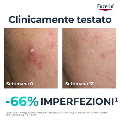 EUCERIN DERMOPURE CLINICAL SIERO TRIPLA AZIONE 40 ML EUCERIN DERMOPURE CLINICAL SIERO TRIPLA AZIONE 40 ML