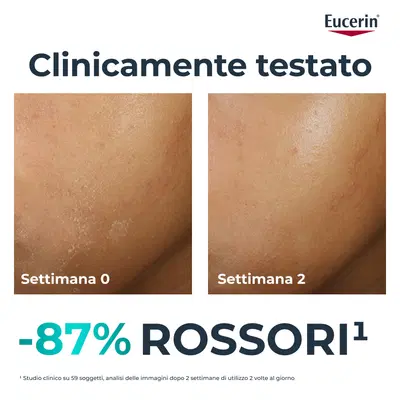 EUCERIN DERMOPURE CLINICAL TRATTAMENTO LENITIVO 40 ML EUCERIN DERMOPURE CLINICAL TRATTAMENTO LENITIVO 40 ML