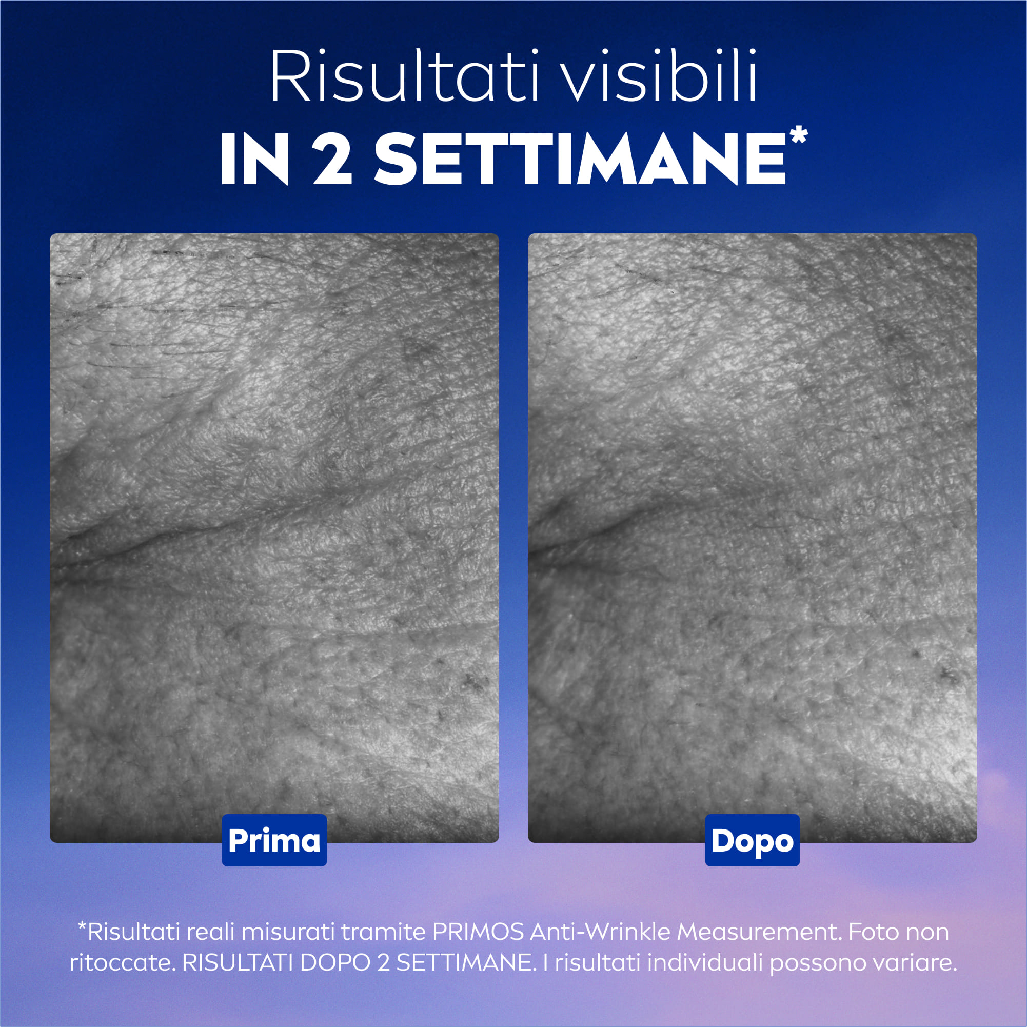 NIVEA CELLULAR EPIGENETICS SIERO RINGIOVANENTE 30 ML