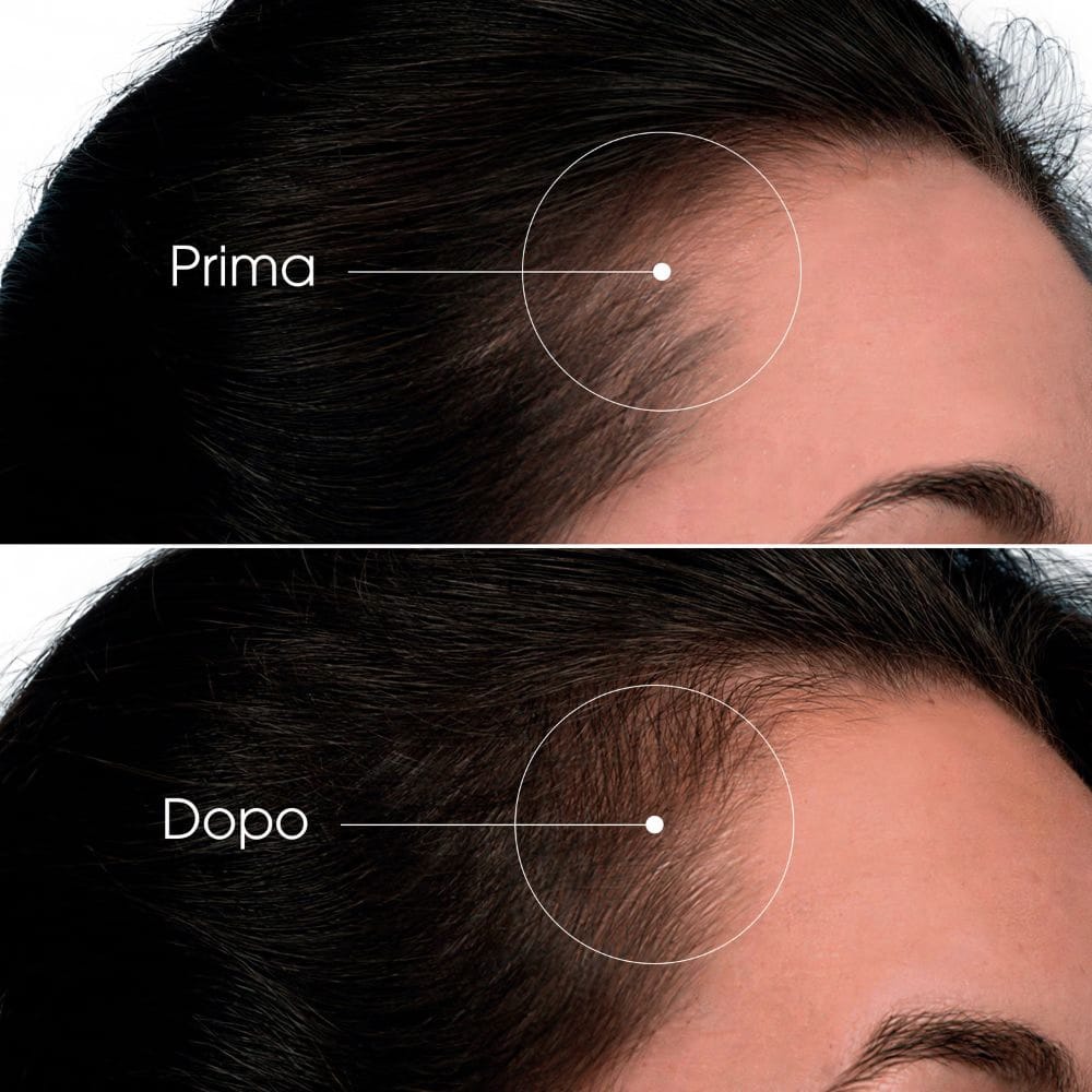 KLORANE SIERO CHININA CRESCITA 100 ML