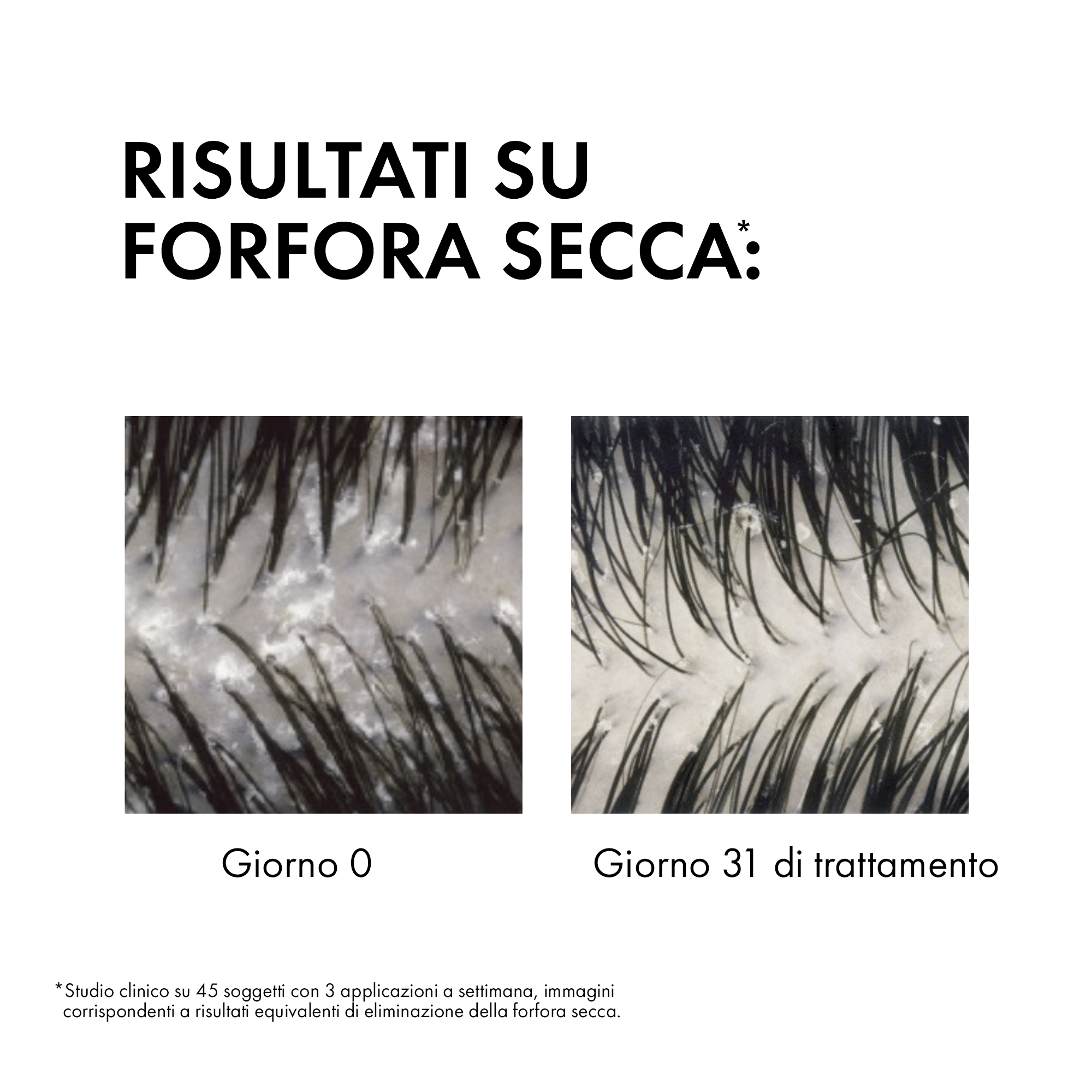 DERCOS SHAMPO ANTIFORFORA SECCHI 390 ML