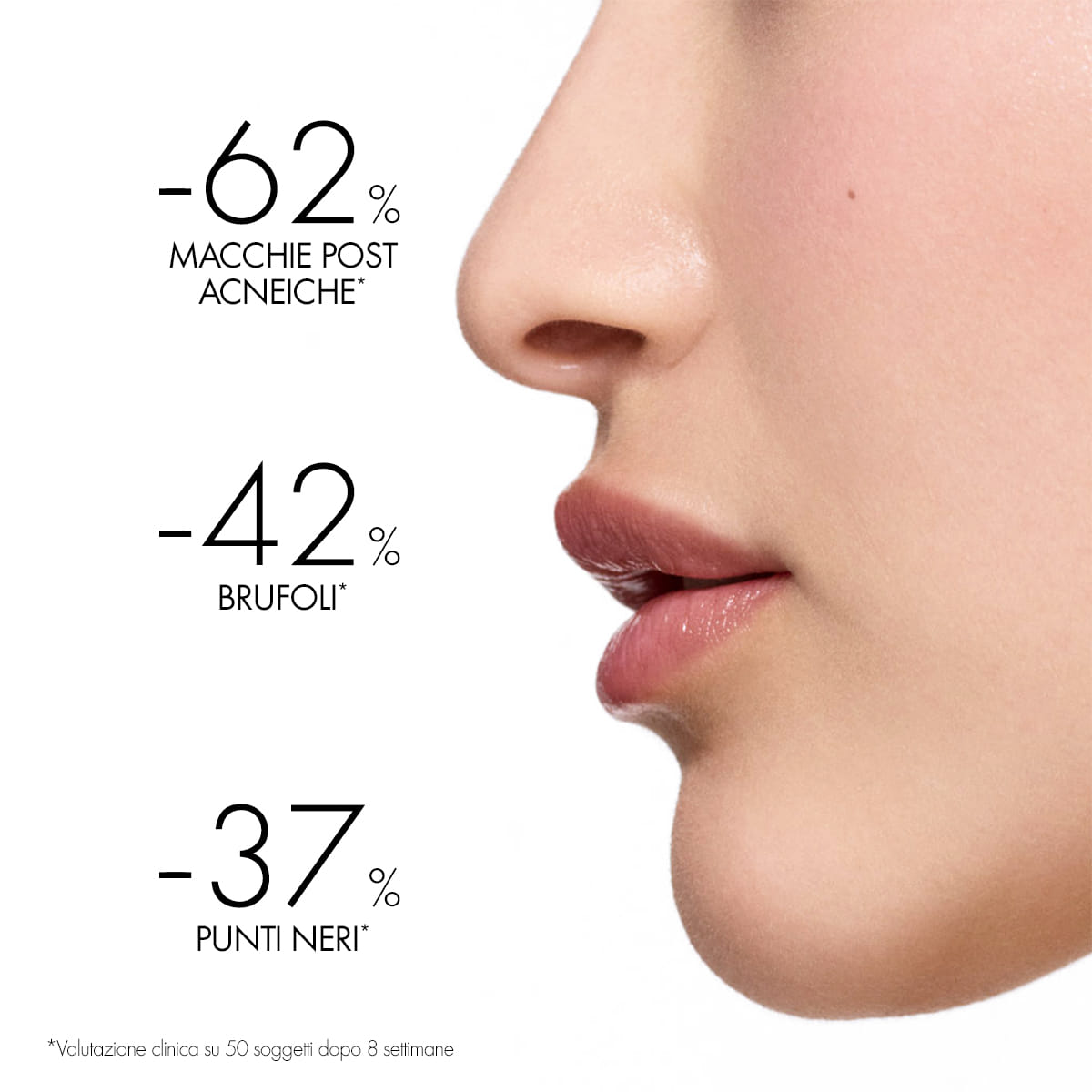 NORMADERM PHYTOSOLUTION TRATTAMENTO 50 ML