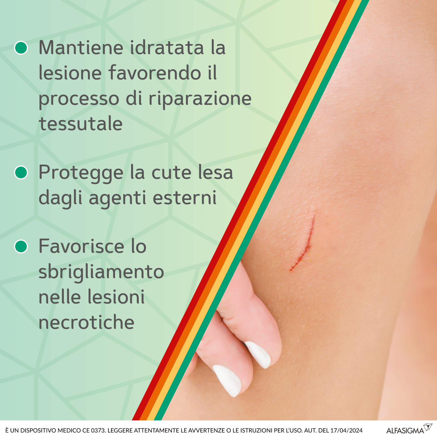 MEDICAZIONE IN GEL SOFARGEN TUBO 25 G