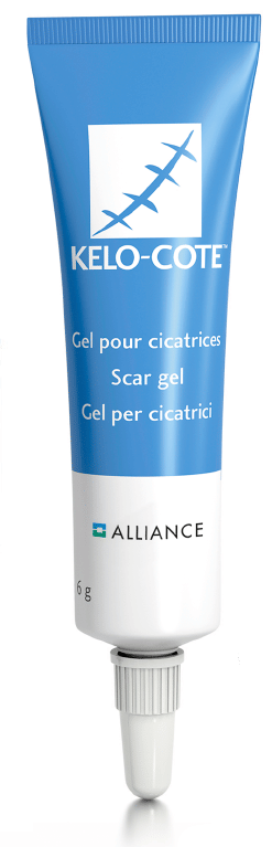 Alliance Pharma 