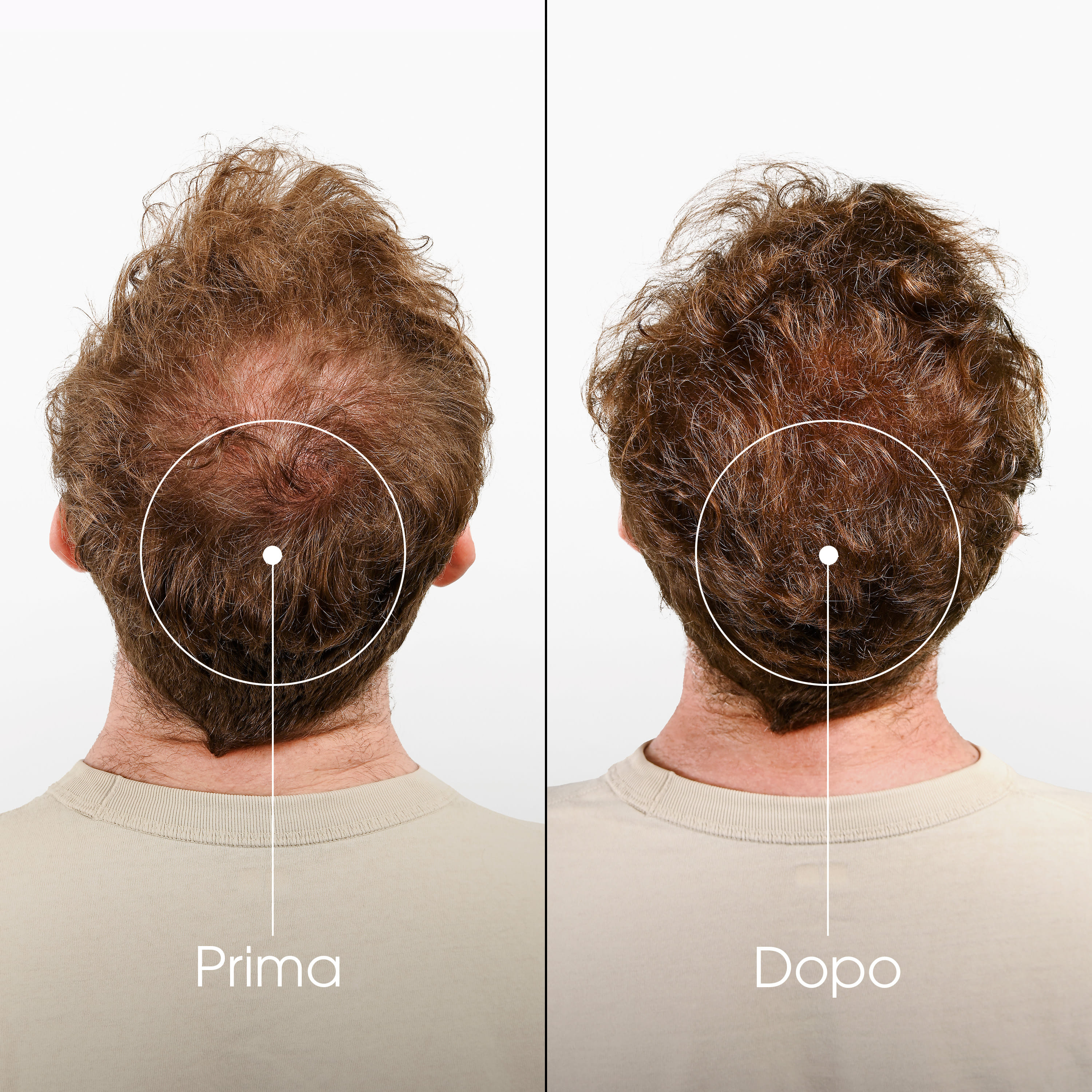 Klorane Shampoo Fortificante & Stimolante alla Chinina, 200ml 