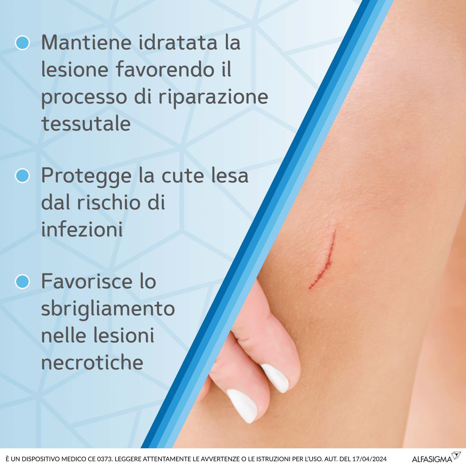 MEDICAZIONE SOFARGEN GEL ACIDO IALURONICO E ARGENTO SULFADIAZINA TUBETTO 25 G