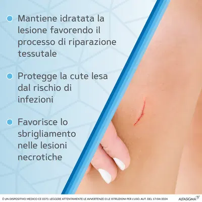 MEDICAZIONE SOFARGEN GEL ACIDO IALURONICO E ARGENTO SULFADIAZINA TUBETTO 25 G MEDICAZIONE SOFARGEN GEL ACIDO IALURONICO E ARGENTO SULFADIAZINA TUBETTO 25 G