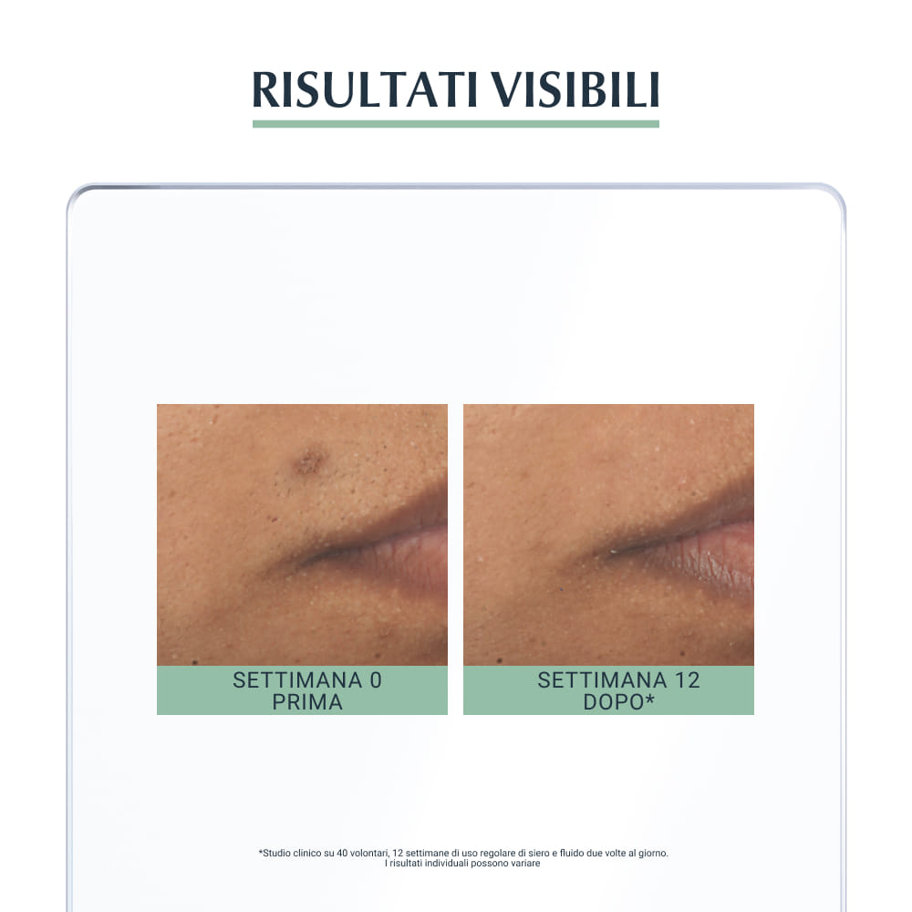 EUCERIN DERMOPURIFYER SIERO TRIPLA AZIONE 40 ML