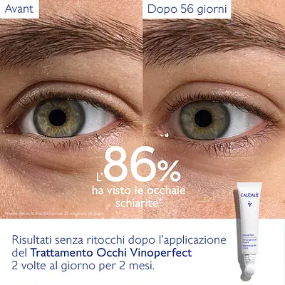 VINOPERFECT TRATTAMENTO OCCHI 2023 15 ML VINOPERFECT TRATTAMENTO OCCHI 2023 15 ML