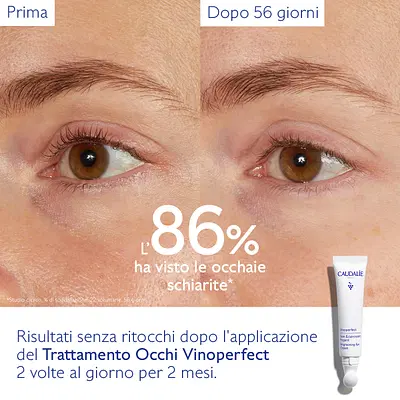 VINOPERFECT TRATTAMENTO OCCHI 2023 15 ML VINOPERFECT TRATTAMENTO OCCHI 2023 15 ML