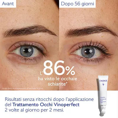 VINOPERFECT TRATTAMENTO OCCHI 2023 15 ML VINOPERFECT TRATTAMENTO OCCHI 2023 15 ML