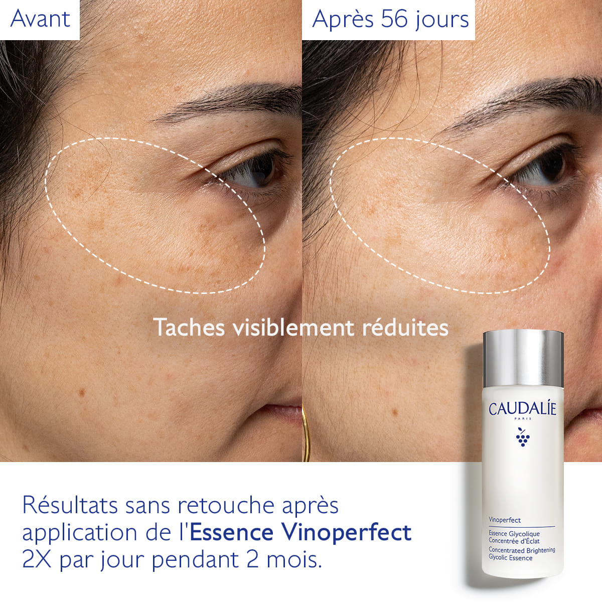 VINOPERFECT ESSENZA GLICOLICA ILLUMINANTE 2023 100 ML
